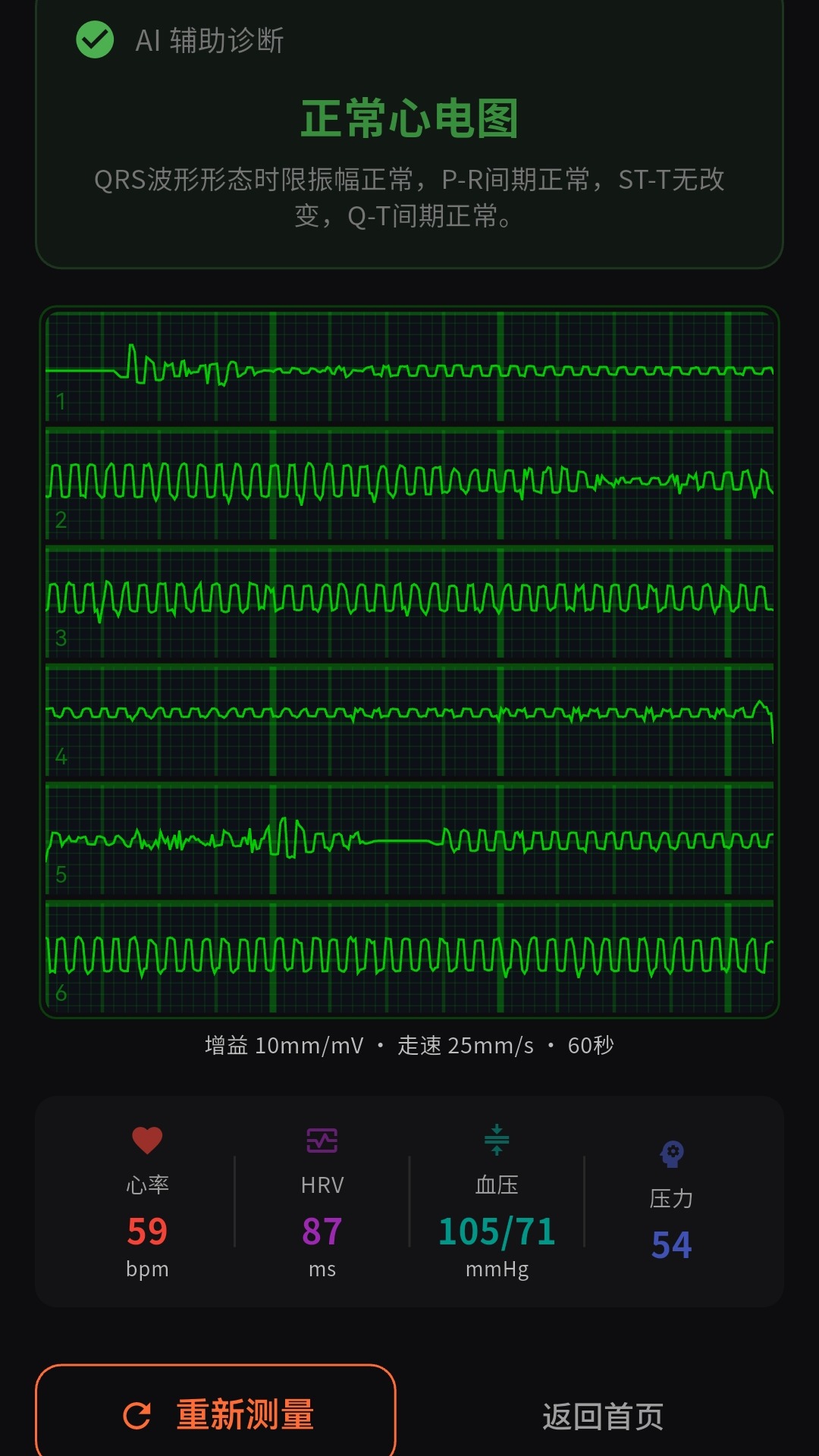 ECG